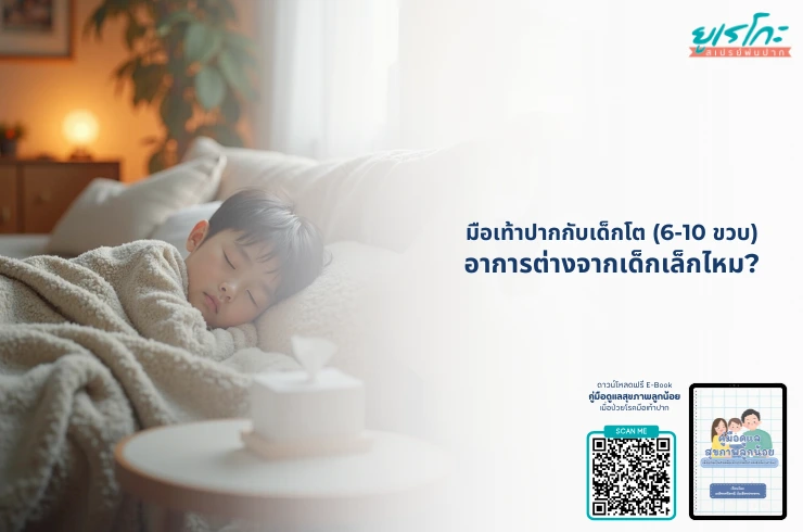 มือเท้าปากกับเด็กโต (6-10 ขวบ): อาการต่างจากเด็กเล็กไหม?